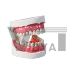 The model of teeth care